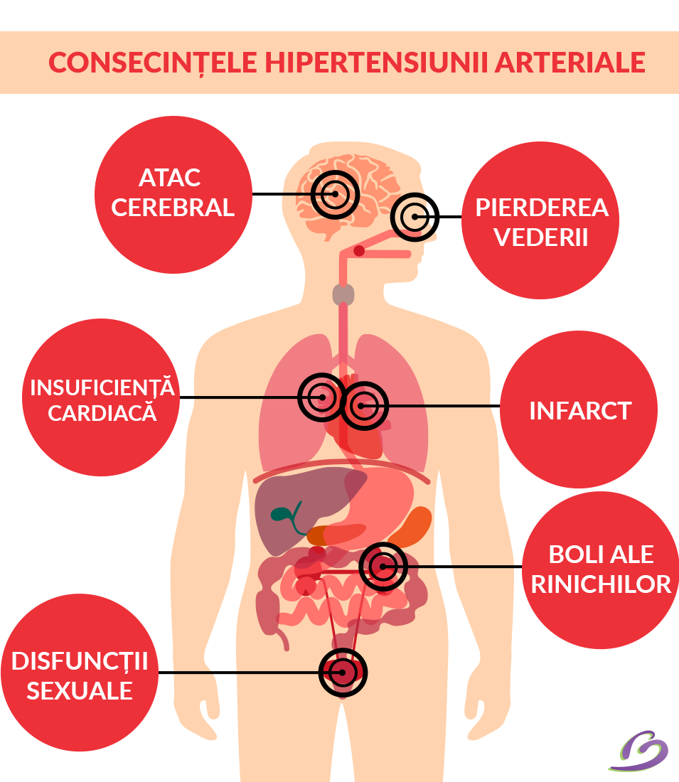 Gimnastica igienica complexa pentru hipertensiune arteriala - punticrisene.ro